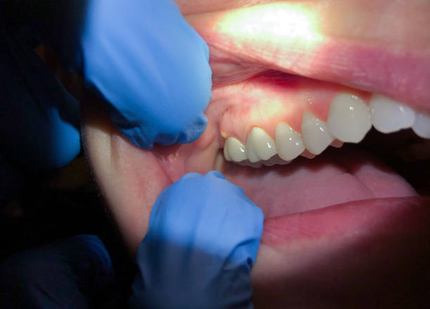 Best Cosmetic Emergency Dentistry in Rochester, IL